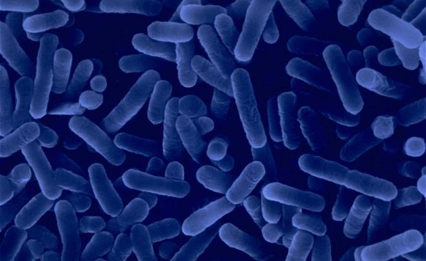 Legionnaires’ outbreak in Edinburgh: More cases expected Legionnaires’ outbreak in Edinburgh: More cases expected